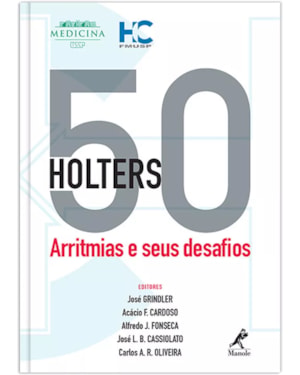 50 holters: Arritmias e seus desafios