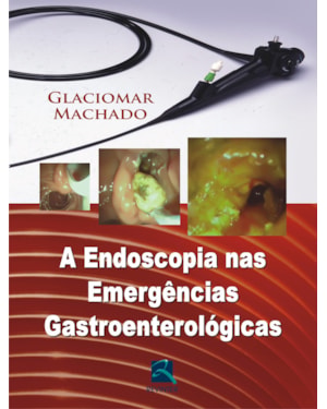 A endoscopia nas emergências gastroenterológicas
