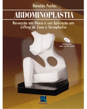 Abdominoplastia: ressecção em bloco e sua aplicação em liffing de coxa e torsoplastia