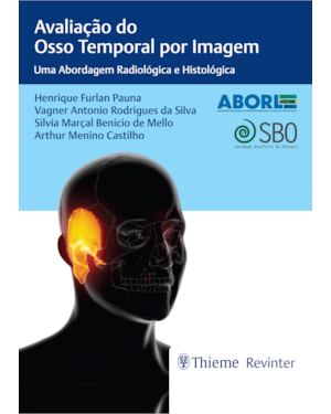 Aborl avaliação do osso temporal por imagem: uma abordagem radiológica e histológica