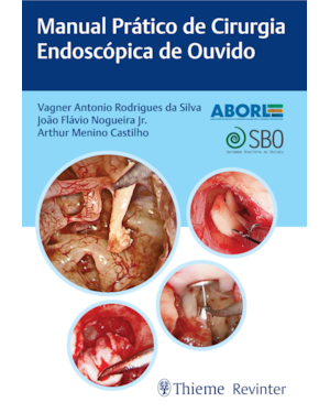 Aborl manual prático de cirurgia endoscópica de ouvido