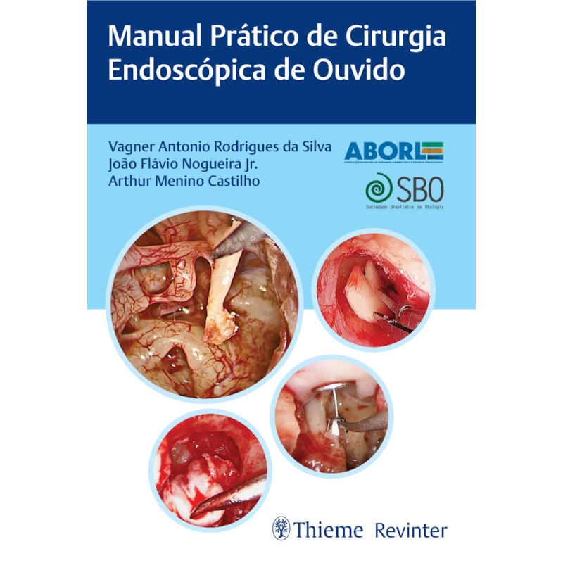 ABORL MANUAL PRÁTICO DE CIRURGIA ENDOSCÓPICA DE OUVIDO