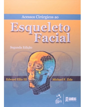 ACESSOS CIRÚRGICOS AO ESQUELETO FACIAL