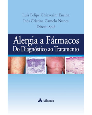 Alergia a fármacos do diagnóstico ao tratamento