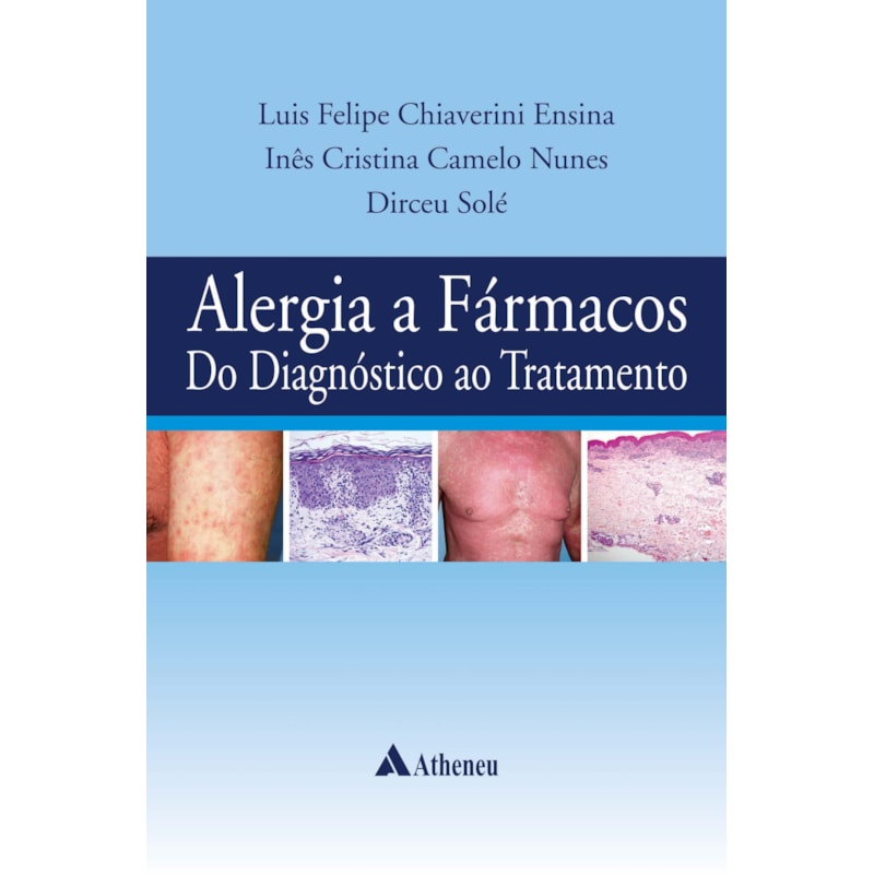 ALERGIA A FÁRMACOS DO DIAGNÓSTICO AO TRATAMENTO