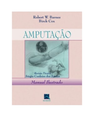 AMPUTAÇÃO