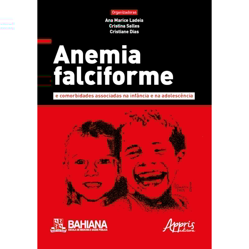 ANEMIA FALCIFORME E COMORBIDADES ASSOCIADAS NA INFÂNCIA E NA ADOLESCÊNCIA