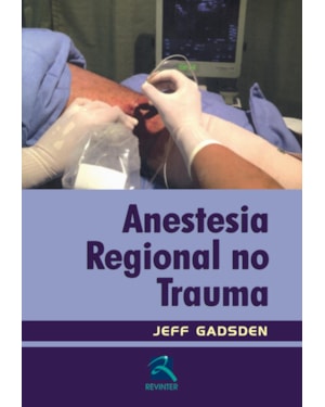 Anestesia regional no trauma