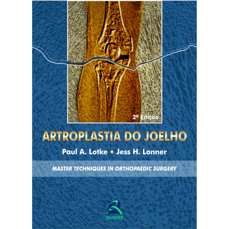 ARTROPLASTIA DO JOELHO: MASTER TECHNIQUES IN ORTHOPAEDIC SURGERY