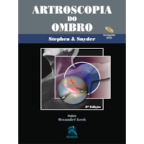 Artroscopia do ombro