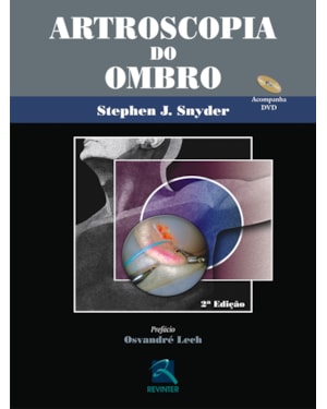 Artroscopia do ombro