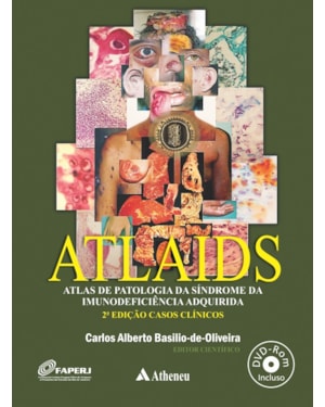 ATLAIDS: atlas de patologia da Síndrome da Imunodeficiência Adquirida