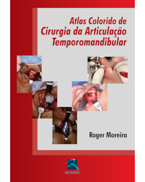 Atlas colorido de cirurgia da articulação temporomandibular