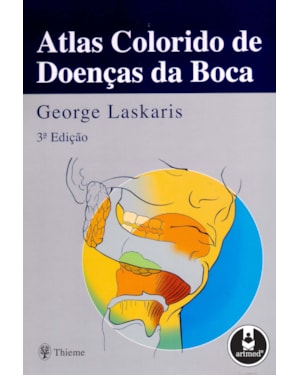 ATLAS COLORIDO DE DOENÇAS DA BOCA
