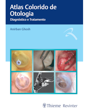 Atlas colorido de otologia: diagnóstico e tratamento