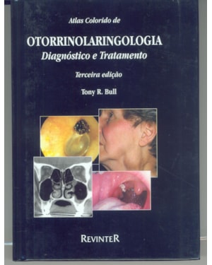 ATLAS COLORIDO DE OTORRINOLARINGOLOGIA