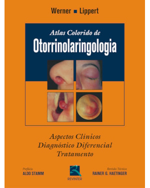 Atlas colorido de otorrinolaringologia: aspectos clínicos, diagnóstico diferencial e tratamento