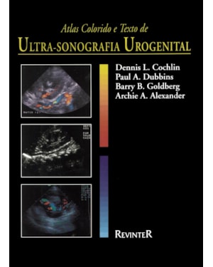 ATLAS COLORIDO E TEXTO DE ULTRASSONOGRAFIA UROGENITAL