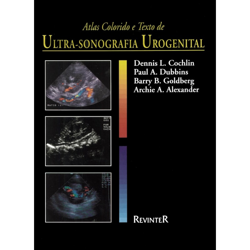 ATLAS COLORIDO E TEXTO DE ULTRASSONOGRAFIA UROGENITAL