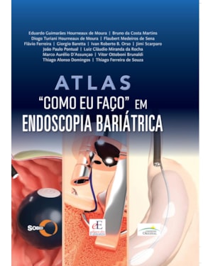 ATLAS: COMO EU FAÇO EM ENDOSCOPIA BARIÁTRICA