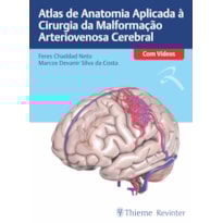 Atlas de Anatomia Aplicada à Cirurgia da Malformação Arteriovenosa Cerebral
