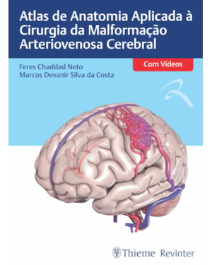 Atlas de Anatomia Aplicada à Cirurgia da Malformação Arteriovenosa Cerebral