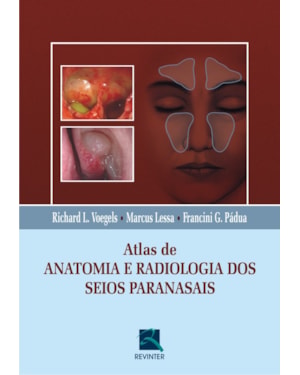 Atlas de anatomia e radiologia dos seios paranasais