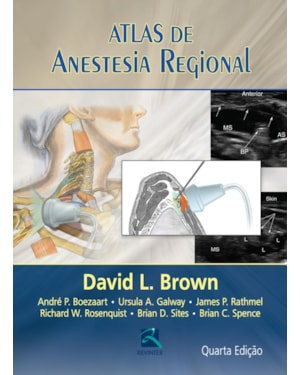 Atlas de anestesia regional
