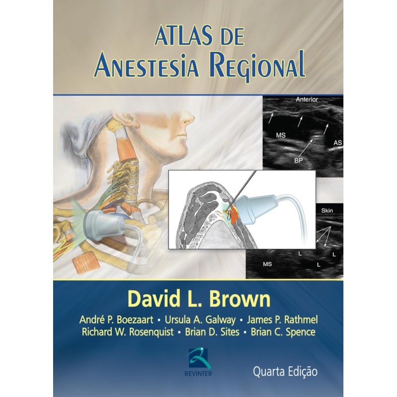 ATLAS DE ANESTESIA REGIONAL