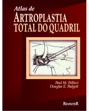 ATLAS DE ARTROPLASTIA DO QUADRIL