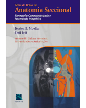 Atlas de bolso de anatomia seccional: tomografia computadorizada e ressonância magnética - Coluna vertebral, extremidades e articulações