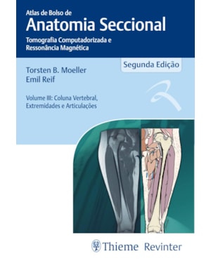 Atlas de Bolso de Anatomia Seccional: Tomografia Computadorizada e Ressonância Magnética - Coluna Vertebral, Extremidades e Articulações