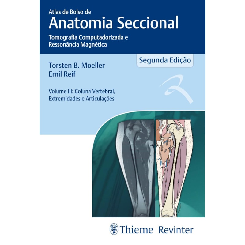 ATLAS DE BOLSO DE ANATOMIA SECCIONAL - TOMOGRAFIA COMPUTADORIZADA E RESSONÂNCIA MAGNÉTICA - VOLUME III: COLUNA VERTEBRAL, EXTREMIDADES E ARTICULAÇÕES
