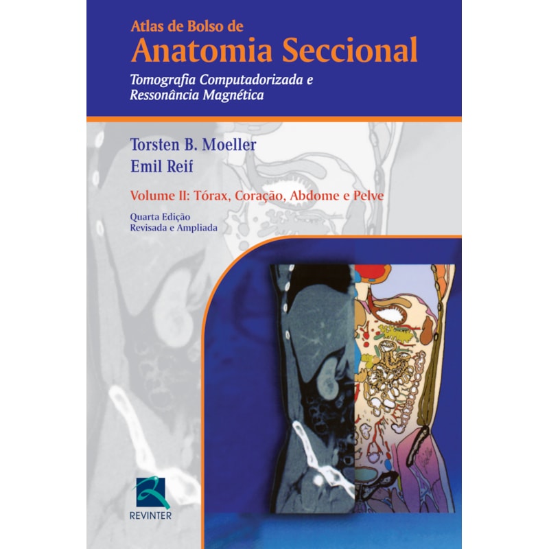 ATLAS DE BOLSO DE ANATOMIA SECCIONAL - TOMOGRAFIA COMPUTADORIZADA E RESSONÂNCIA MAGNÉTICA - VOLUME II: TÓRAX, CORAÇÃO, ABDOME E PELVE