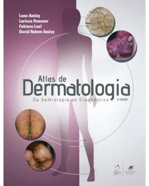 ATLAS DE DERMATOLOGIA - DA SEMIOLOGIA AO DIAGNÓSTICO