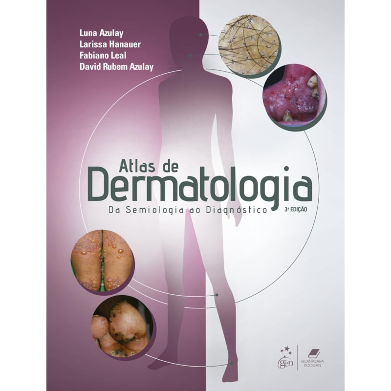 ATLAS DE DERMATOLOGIA - DA SEMIOLOGIA AO DIAGNÓSTICO