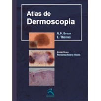 ATLAS DE DERMOSCOPIA