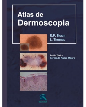 Atlas de dermoscopia