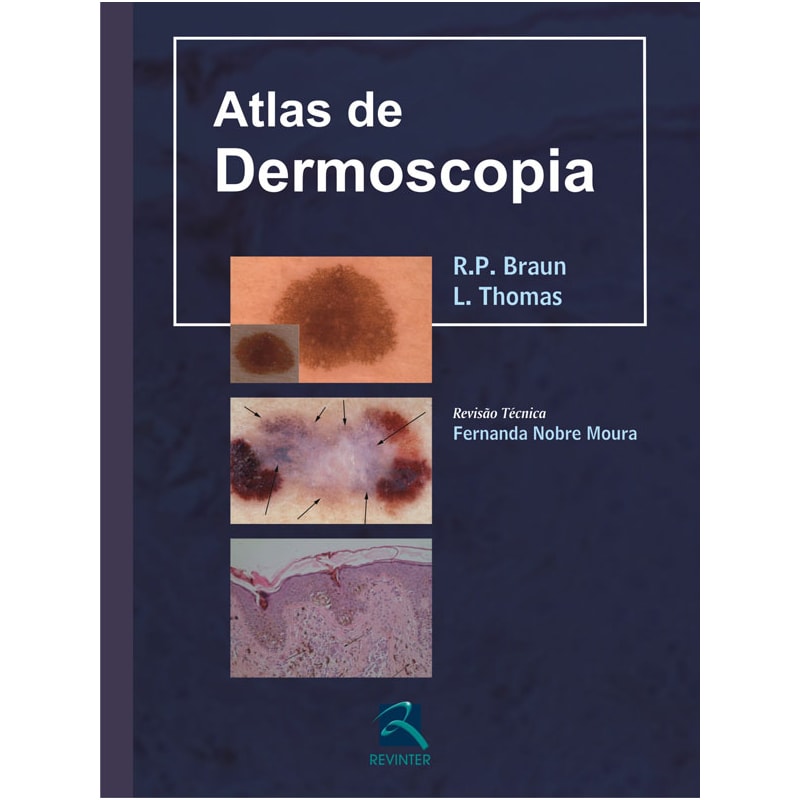 ATLAS DE DERMOSCOPIA