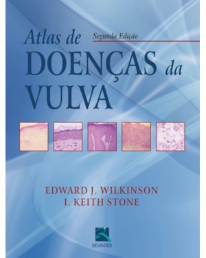 Atlas de doenças da vulva