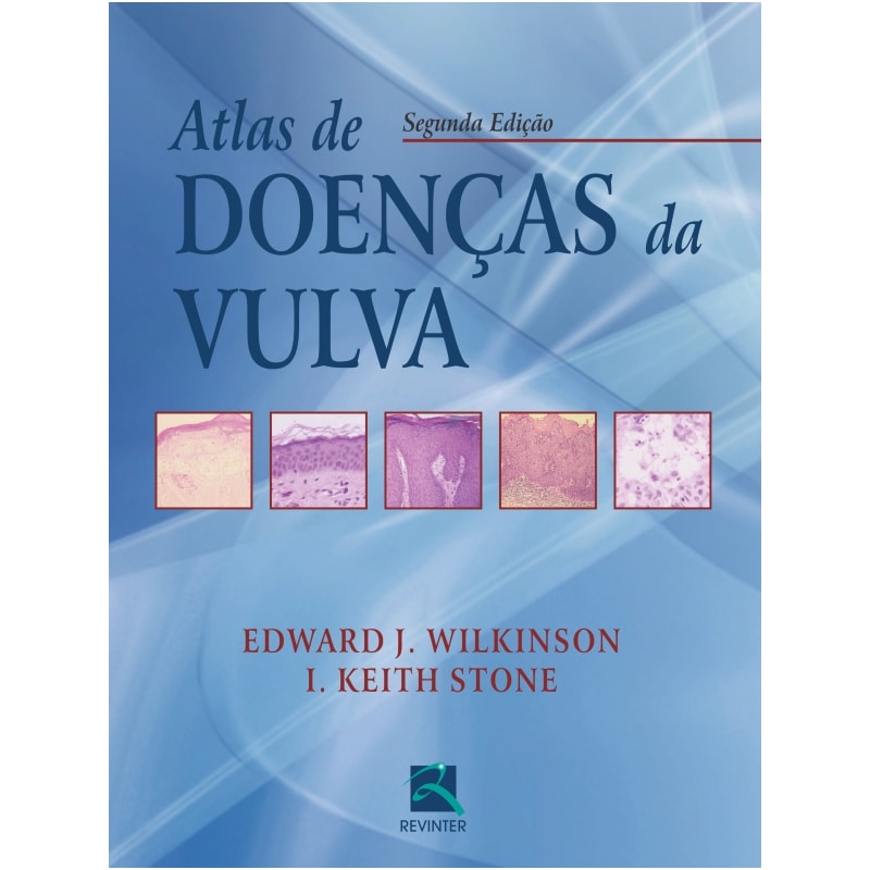 ATLAS DE DOENÇAS DA VULVA