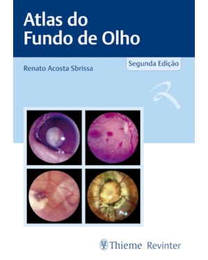 Atlas de fundo de olho