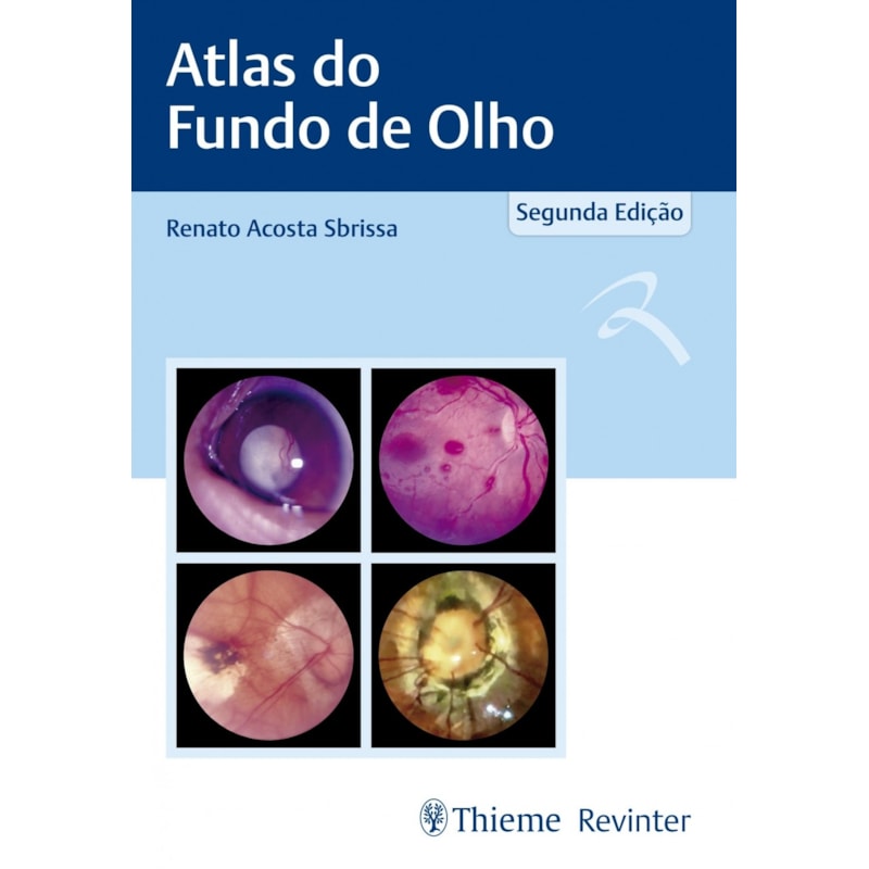 Atlas de fundo de olho
