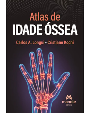Atlas de idade óssea