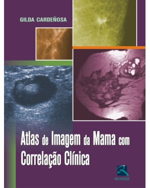 Atlas de imagem da mama com correlação clínica