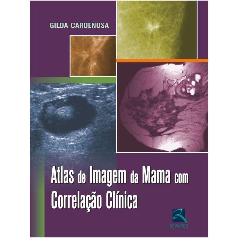ATLAS DE IMAGEM DA MAMA COM CORRELAÇÃO CLÍNICA