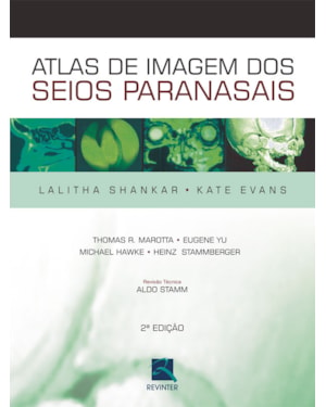 Atlas de imagem dos seios paranasais