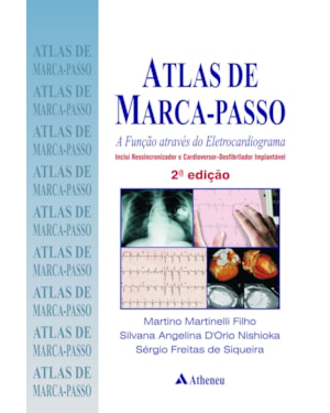 Atlas de marca-passo - A função através do eletrocardiograma