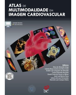 ATLAS DE MULTIMODALIDADE EM IMAGEM CARDIOVASCULAR