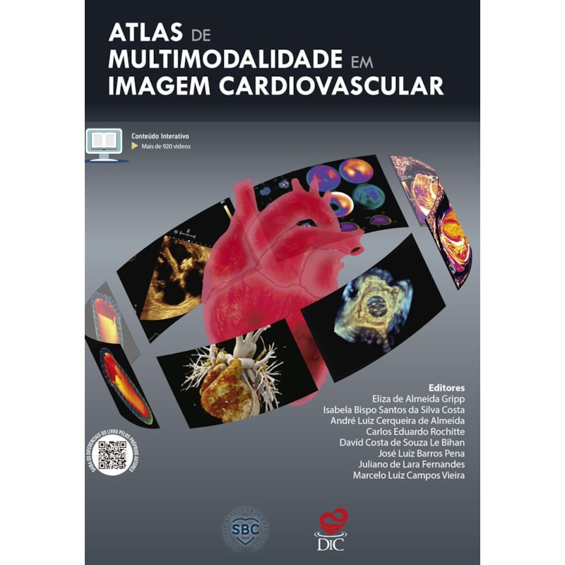 ATLAS DE MULTIMODALIDADE EM IMAGEM CARDIOVASCULAR